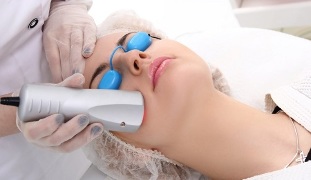 laser facial skin rejuvenation