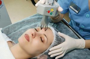 Fractional Laser Facial Skin Rejuvenation
